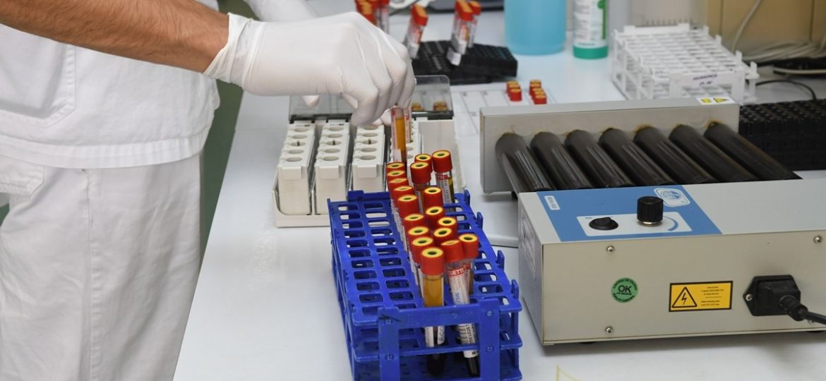 bolnica-seroloski-testovi-korona-laboratorij09